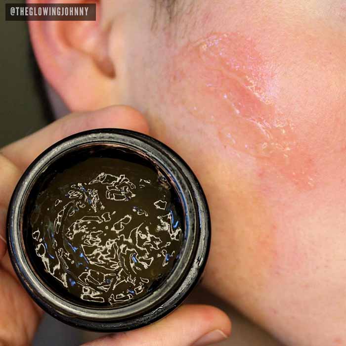 Fighter Gel - Breakout Calming Gel