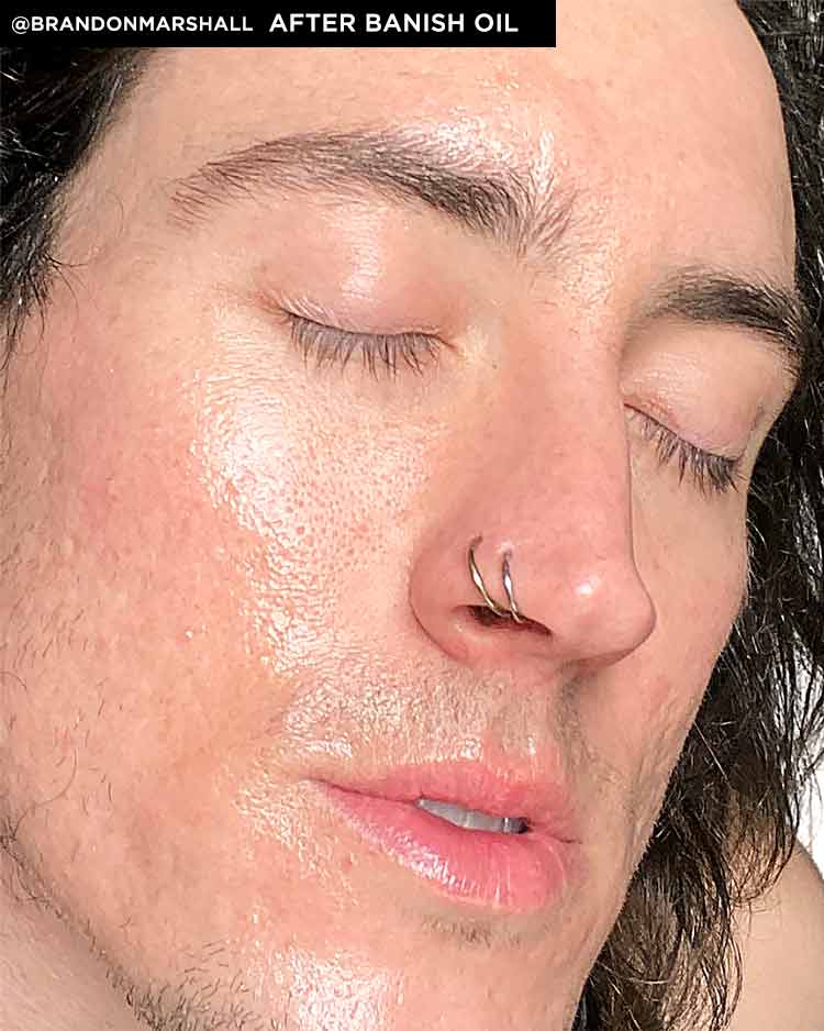 Banish Serum - Vitamin C Serum Dark Spot Corrector